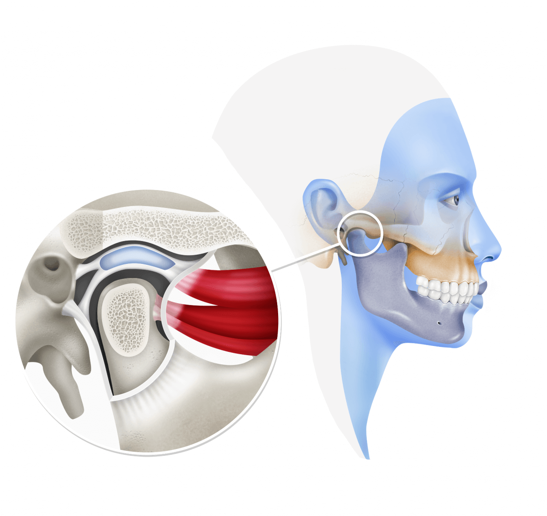 Articulación Temporomandibular: Características y Patología