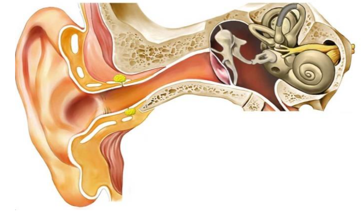 Otalgia secundaria o dolor de oído